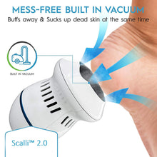 Load image into Gallery viewer, Scalli™ 2.0